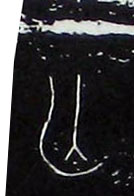 �������ϸ����